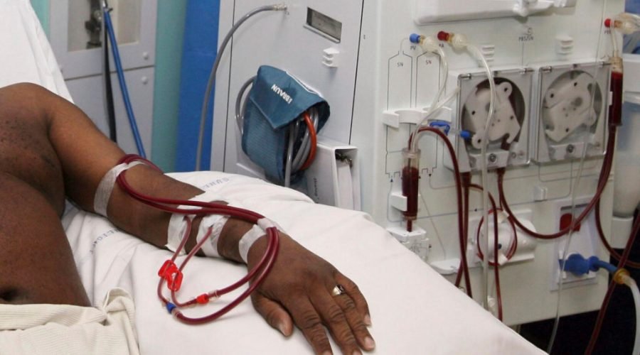 Kidney-dialysis-1024x683