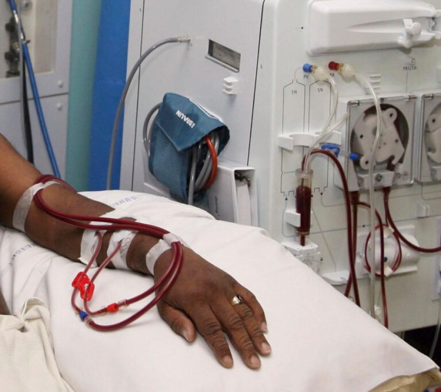 Kidney-dialysis-1024x683