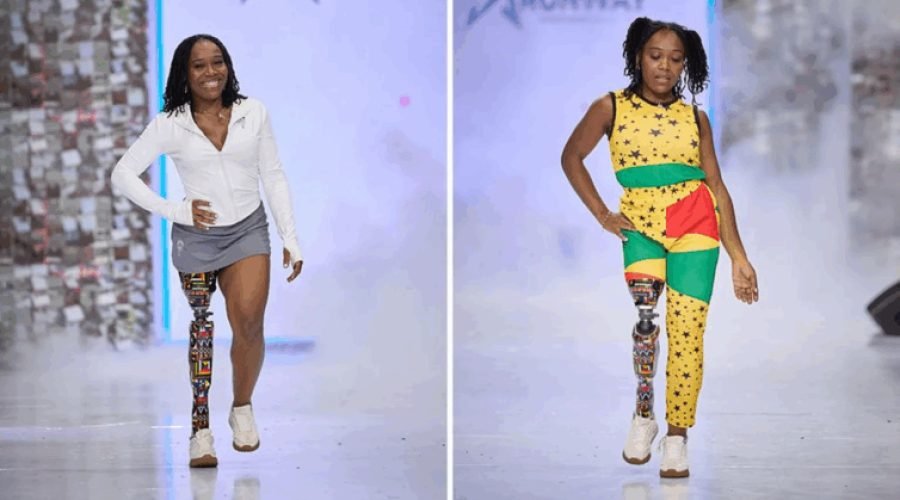 Model moves to Ghana, adorns prosthetic leg with local fabric
