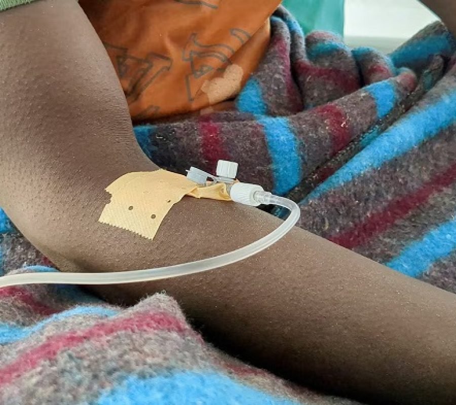 cholera