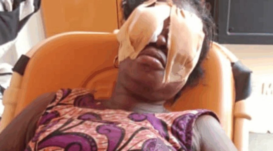 Suspect remanded for eye stabbing; victim seeks treatment abroad