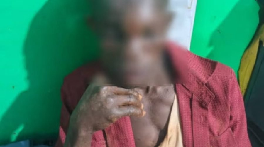 Man arrested for stabbing relative's eyes in domestic dispute